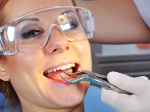 Dental extractions with Happy Smiles Dental services in Clarksburg