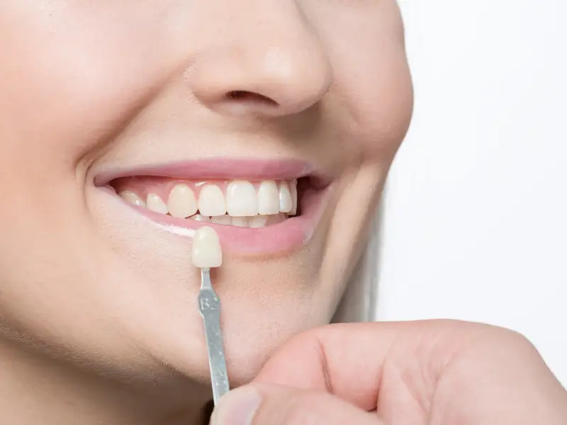 Comprehensive veneers Dental Services for a Healthy Smile